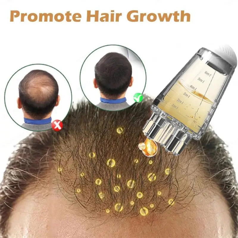 Hair Oil Applicator Comb Bottle with Scalp Massager Roller Root Comb Anti Leak Hair Oil Dispenser for Hair Growth and Scalp Care (Transparent 10ml)